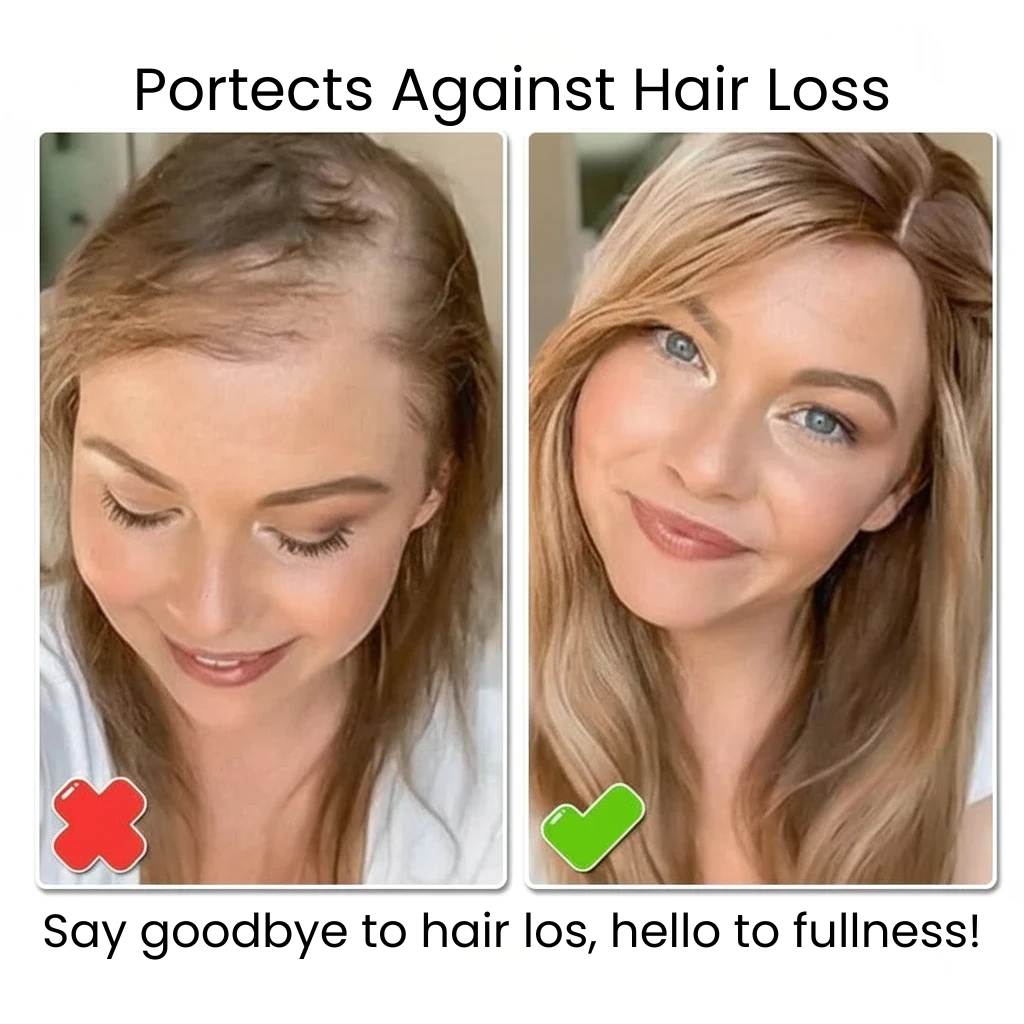 Biancat™ - Lunève Biotin Hair Growth Essence Spray (New Formula)